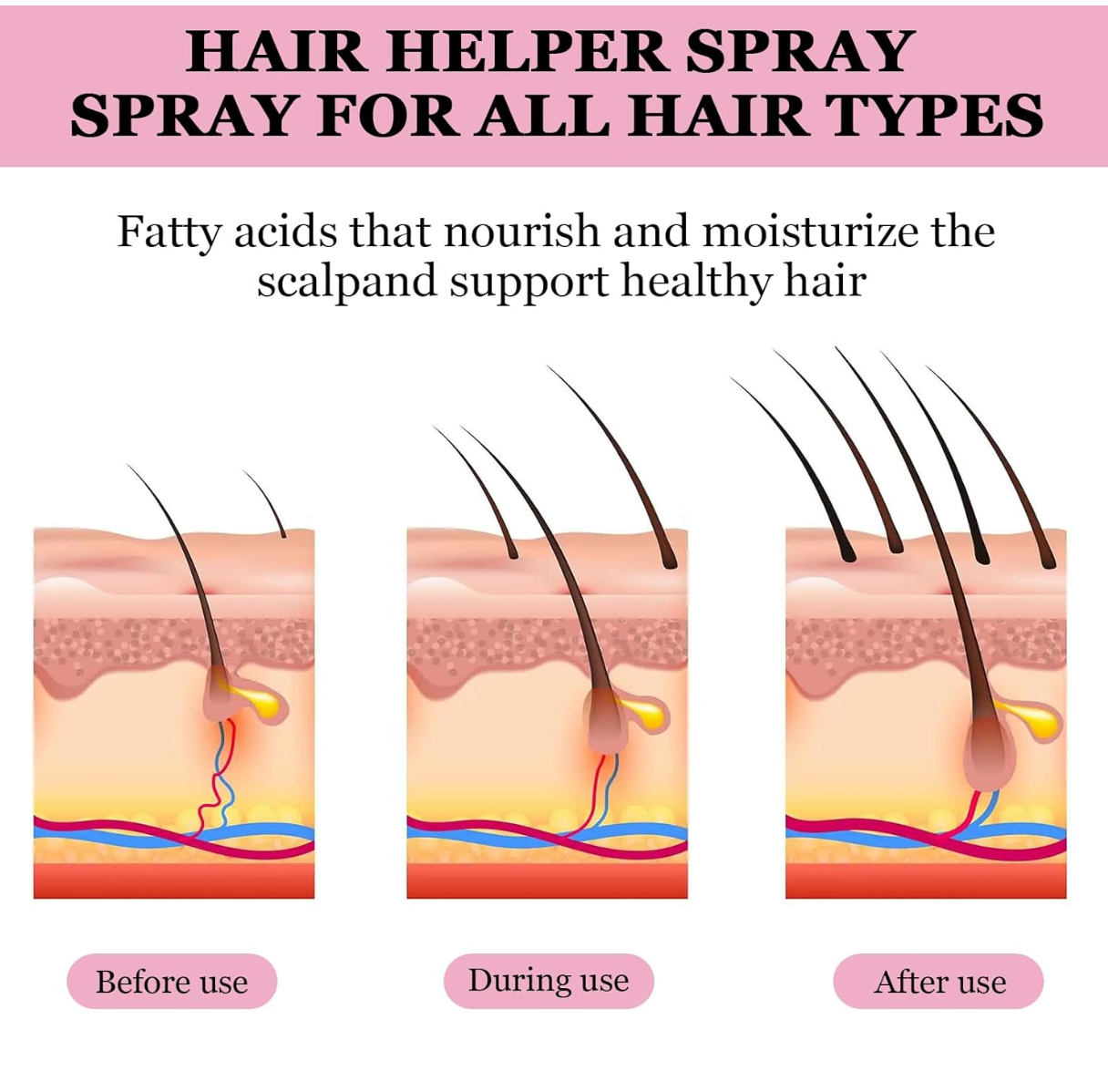 Zephta® H-Regrow 2.0