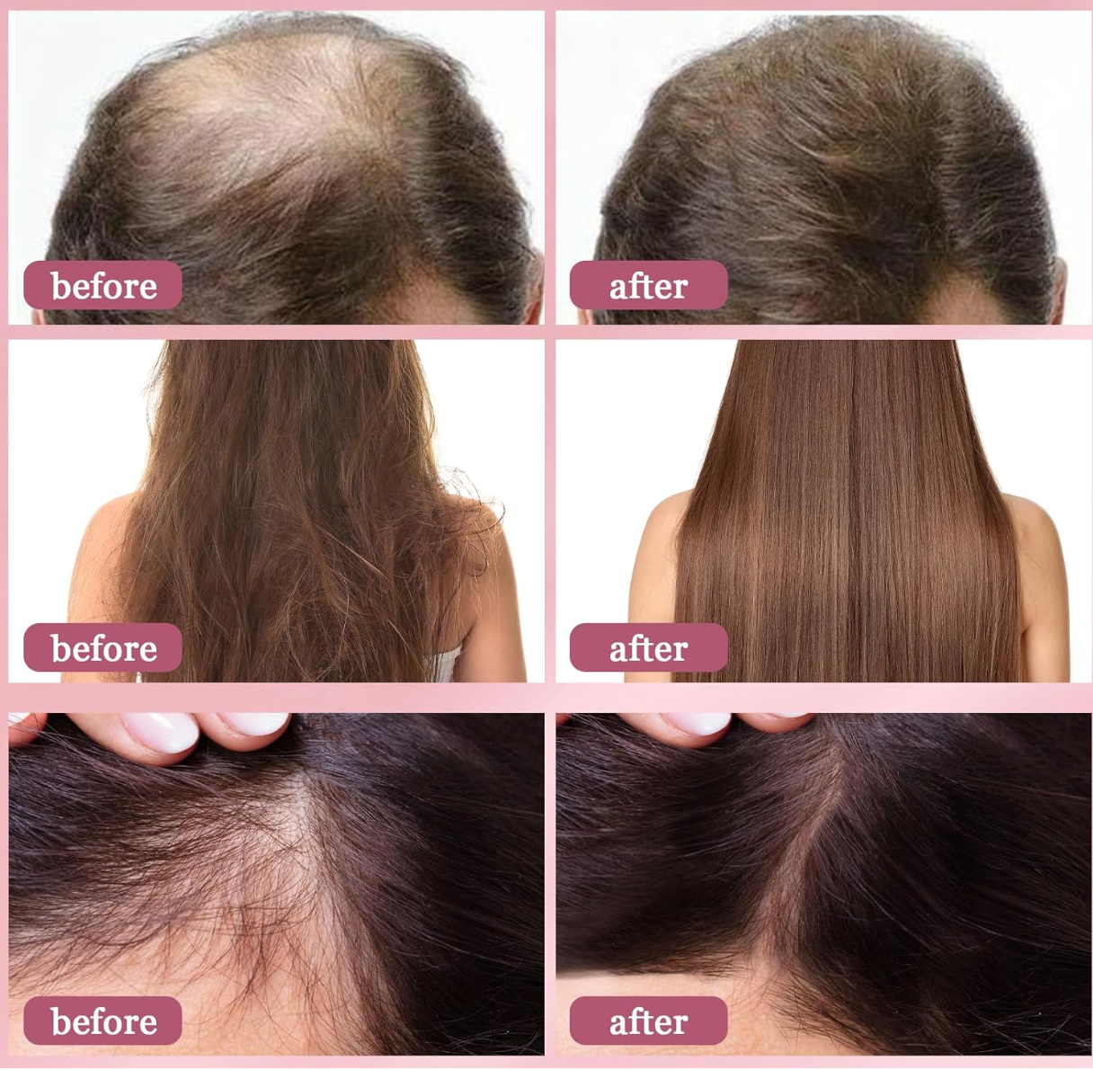 Zephta® H-Regrow 2.0